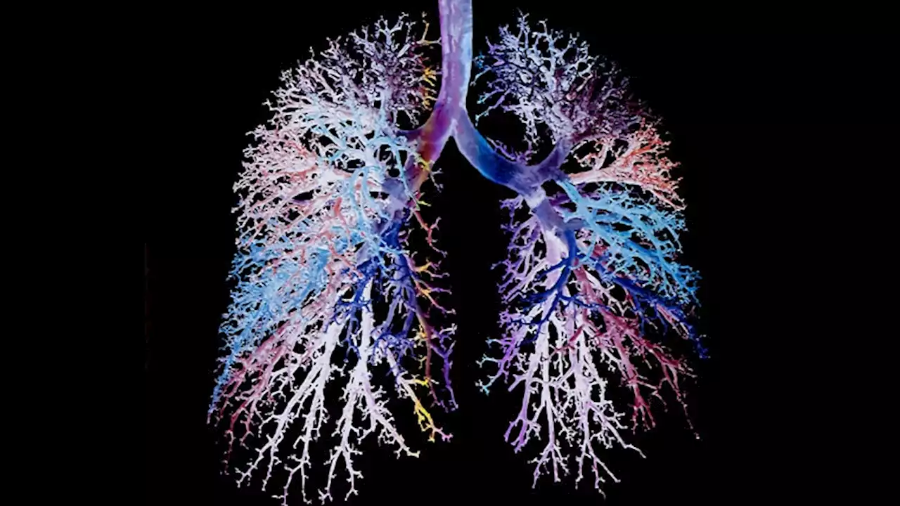 Fast Five Quiz: Systemic Sclerosis Interstitial Lung Disease