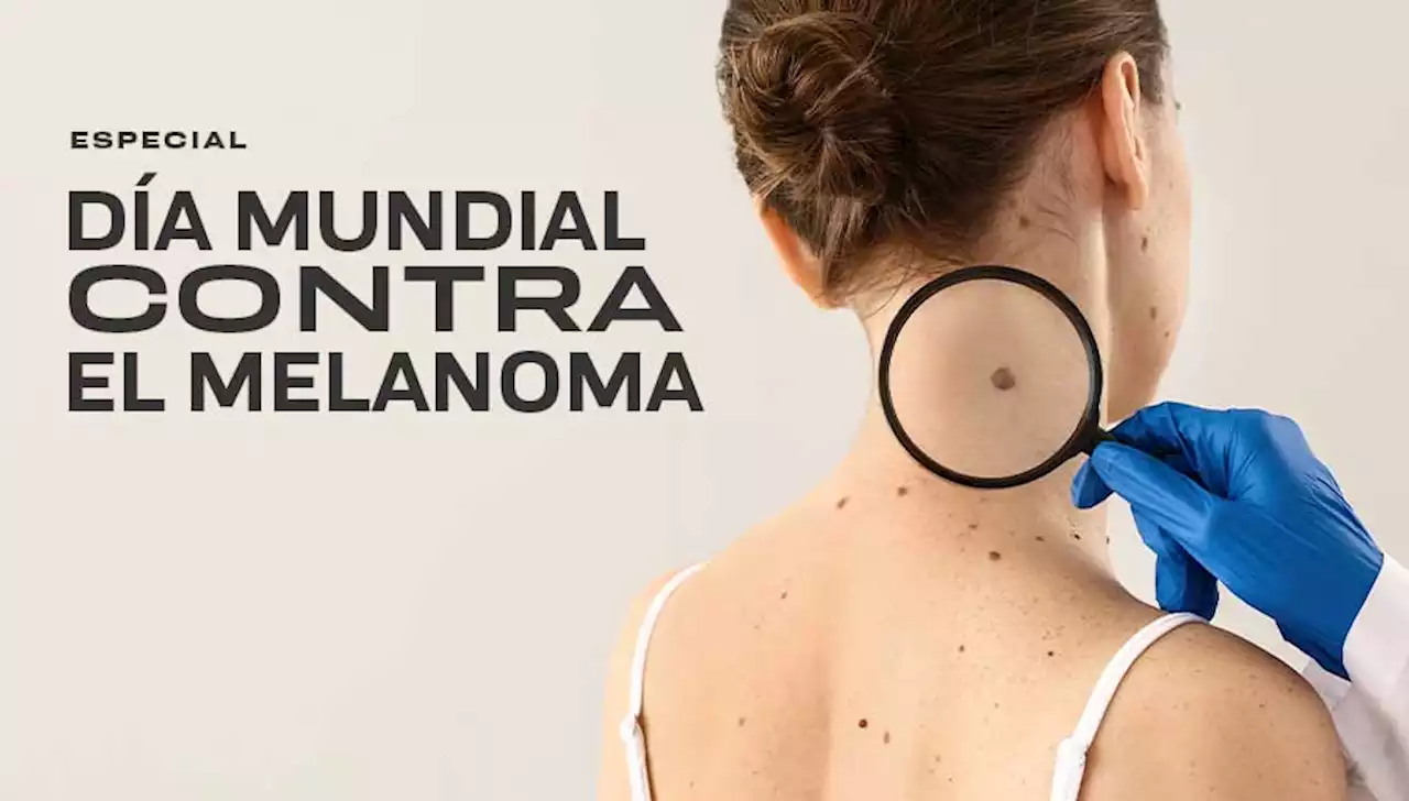 Especial: Día Mundial contra el Melanoma - UNAM Global