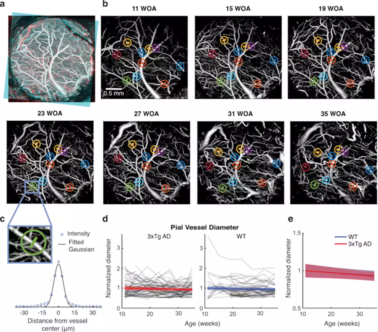 Near-lifespan longitudinal tracking of brain microvascular morphology, topology, and flow in male mice - Nature Communications