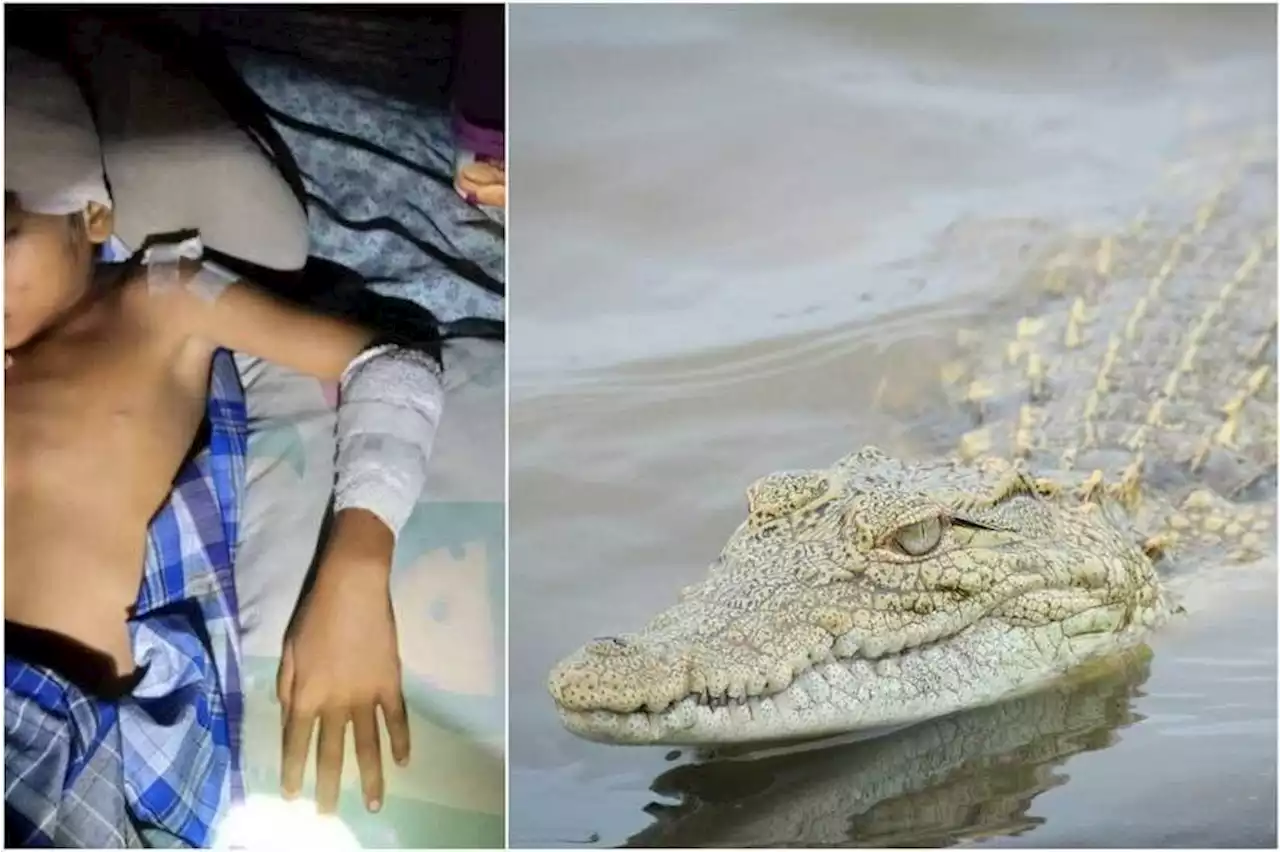 9-year-old boy in Malaysia fights off croc who attacked him on his swim home