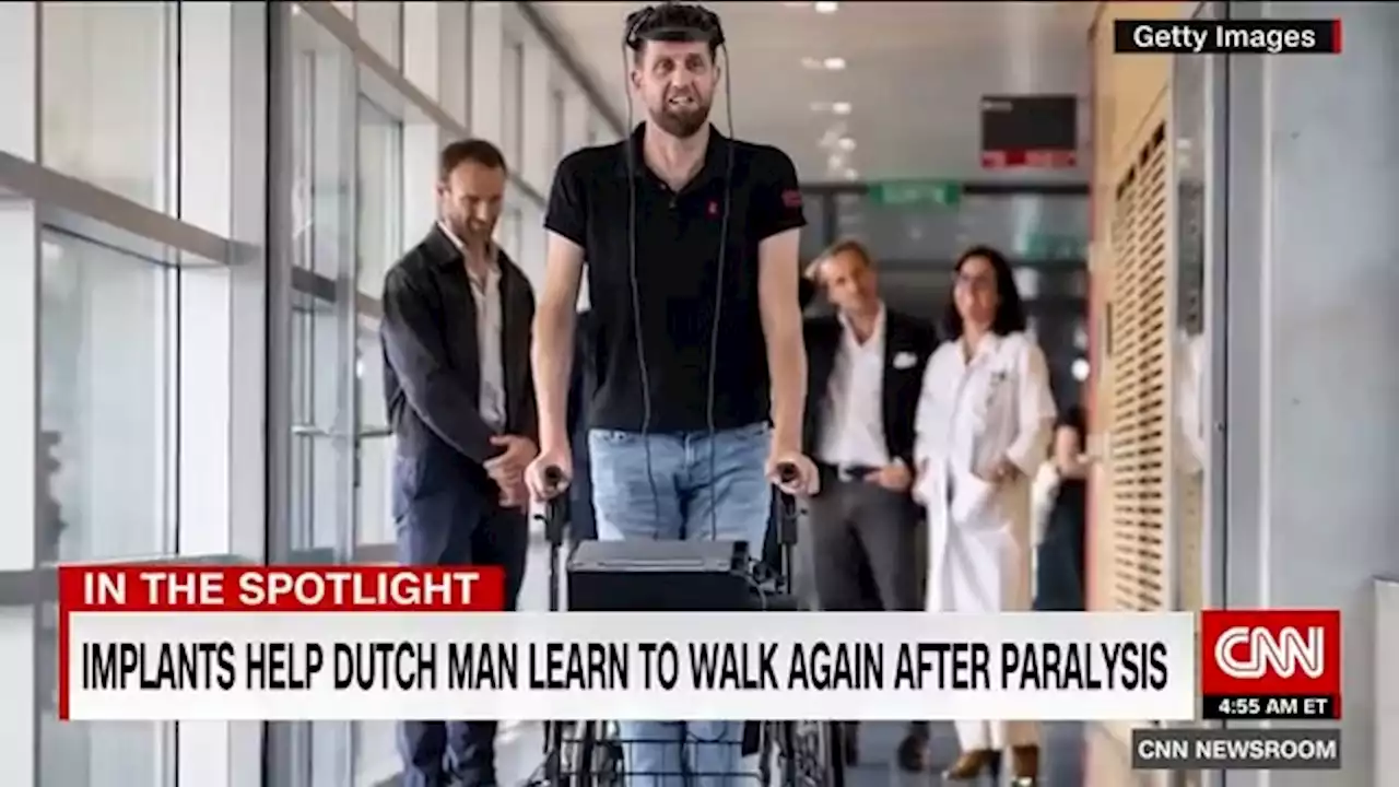 Man with paralysis walks naturally after brain, spine implants | CNN