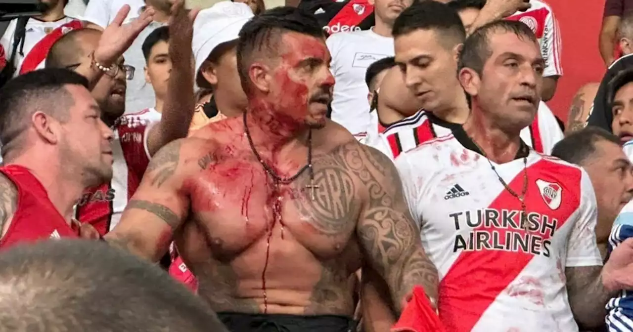 Video: uno de los líderes de la barra de River, herido en Lima