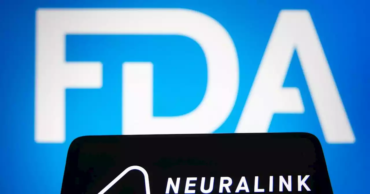 Neuralink receives FDA clearance to begin human trials of its brain-computer interface | Engadget