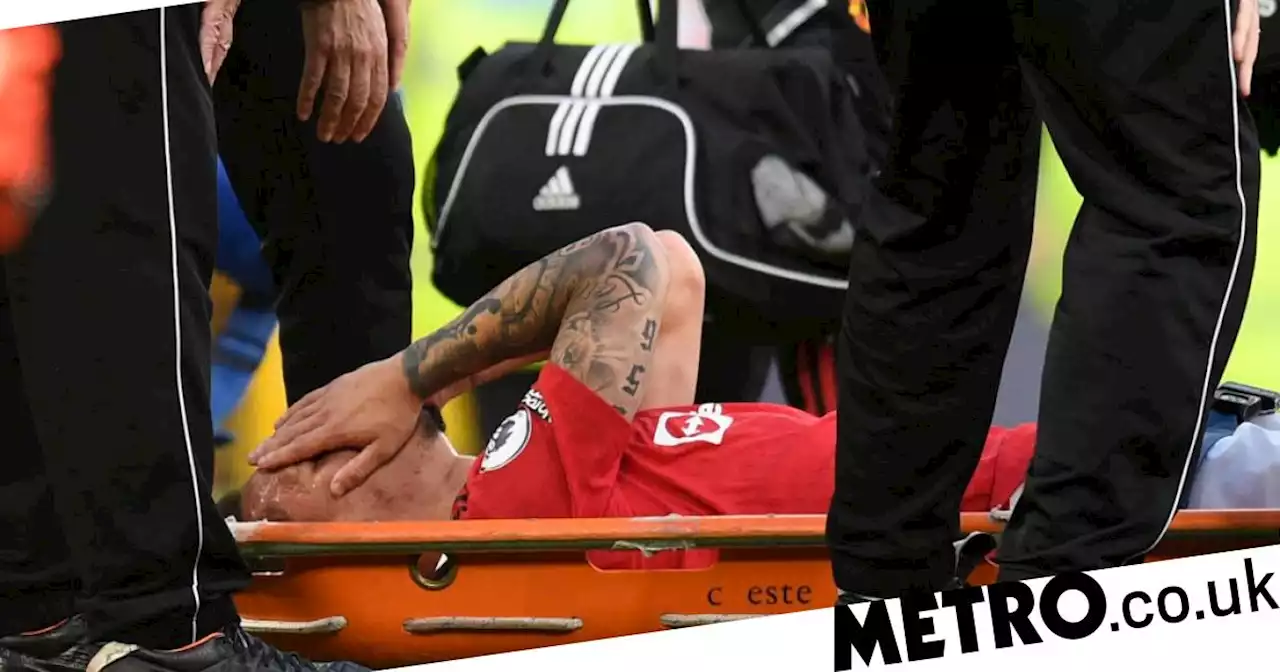 Man Utd star stretchered off in agony against Chelsea in huge FA Cup injury blow