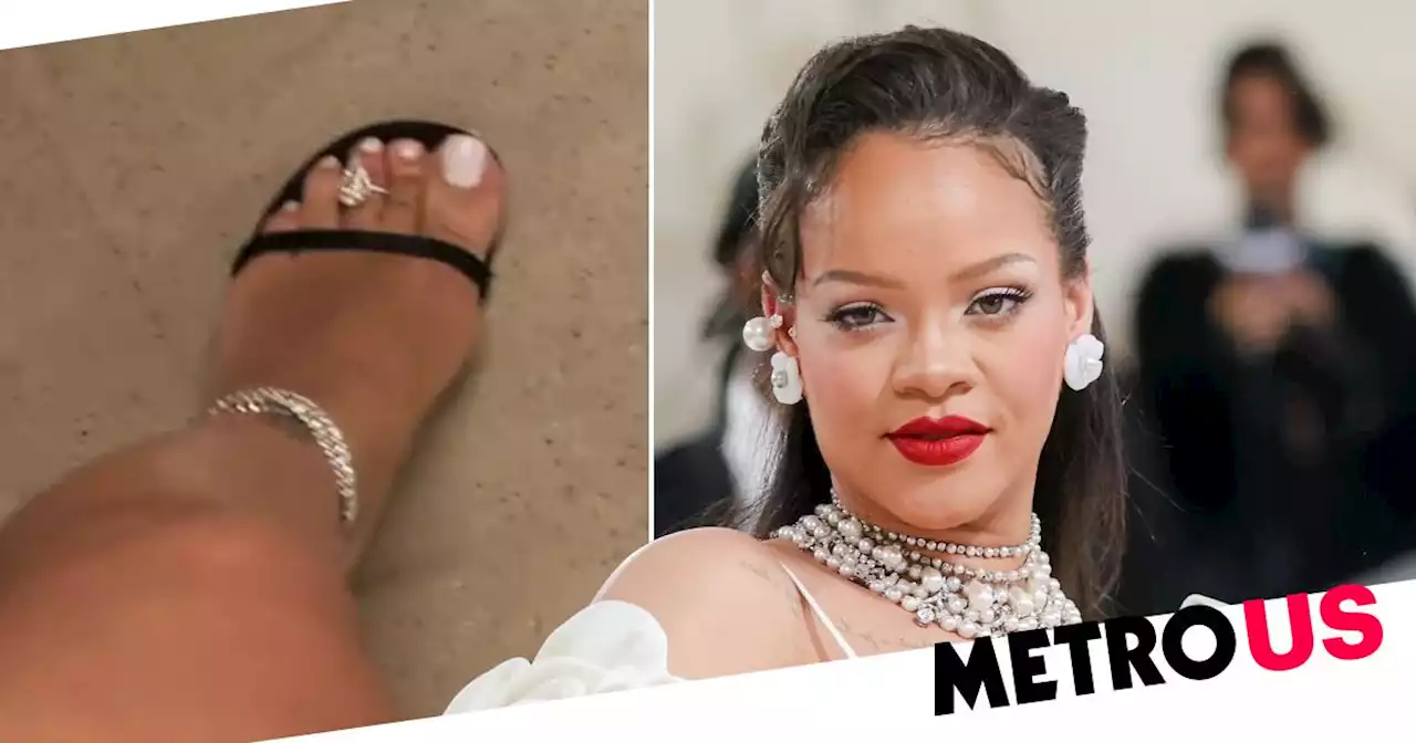 Rihanna has the biggest diamond toe ring we've ever seen, of course