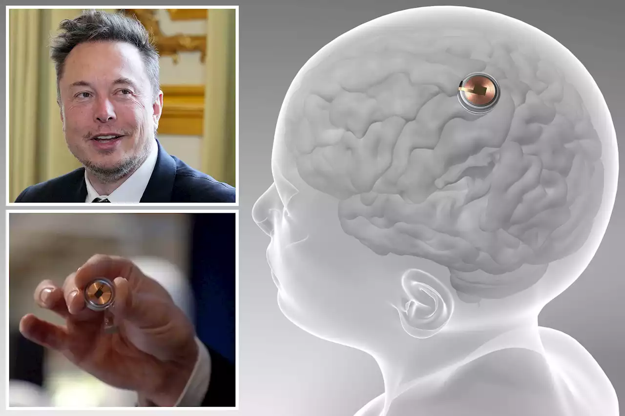 Elon Musk cheers approval to test Neuralink brain implants on humans