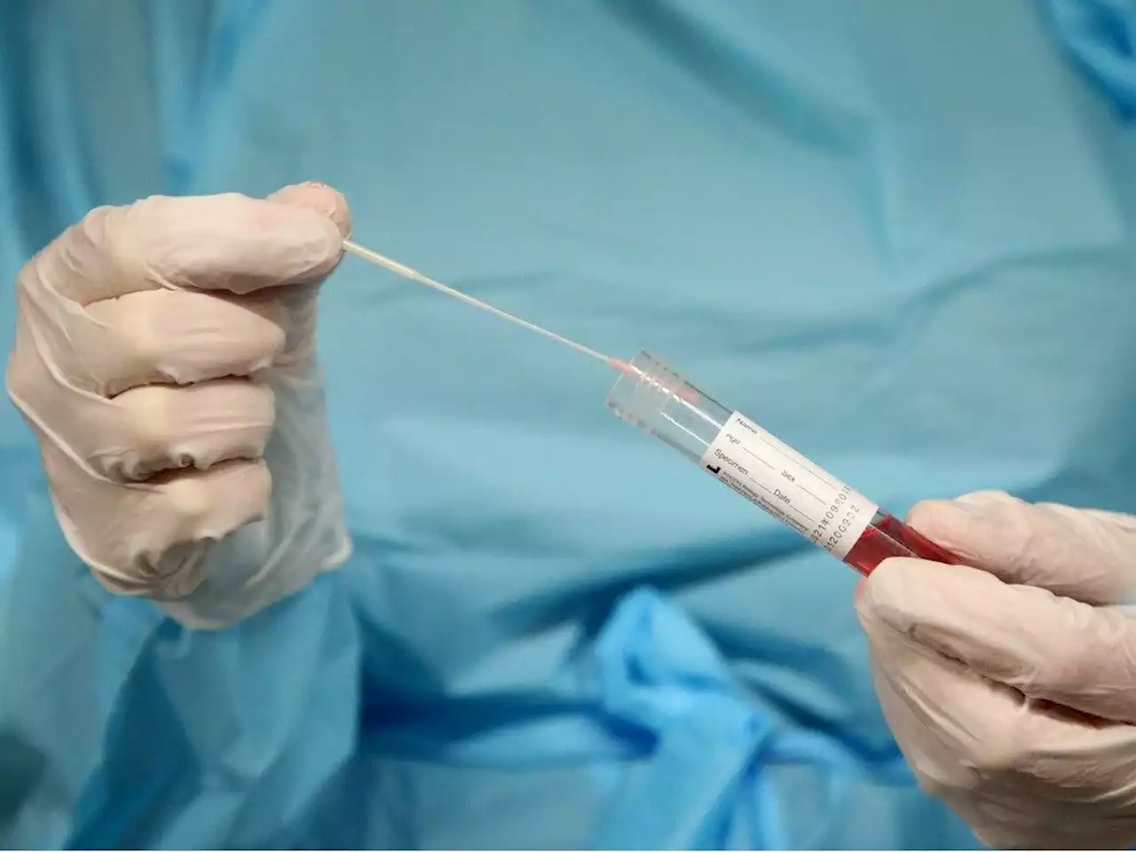 COVID-19: Three more deaths recorded in Ottawa; but other statistics stable
