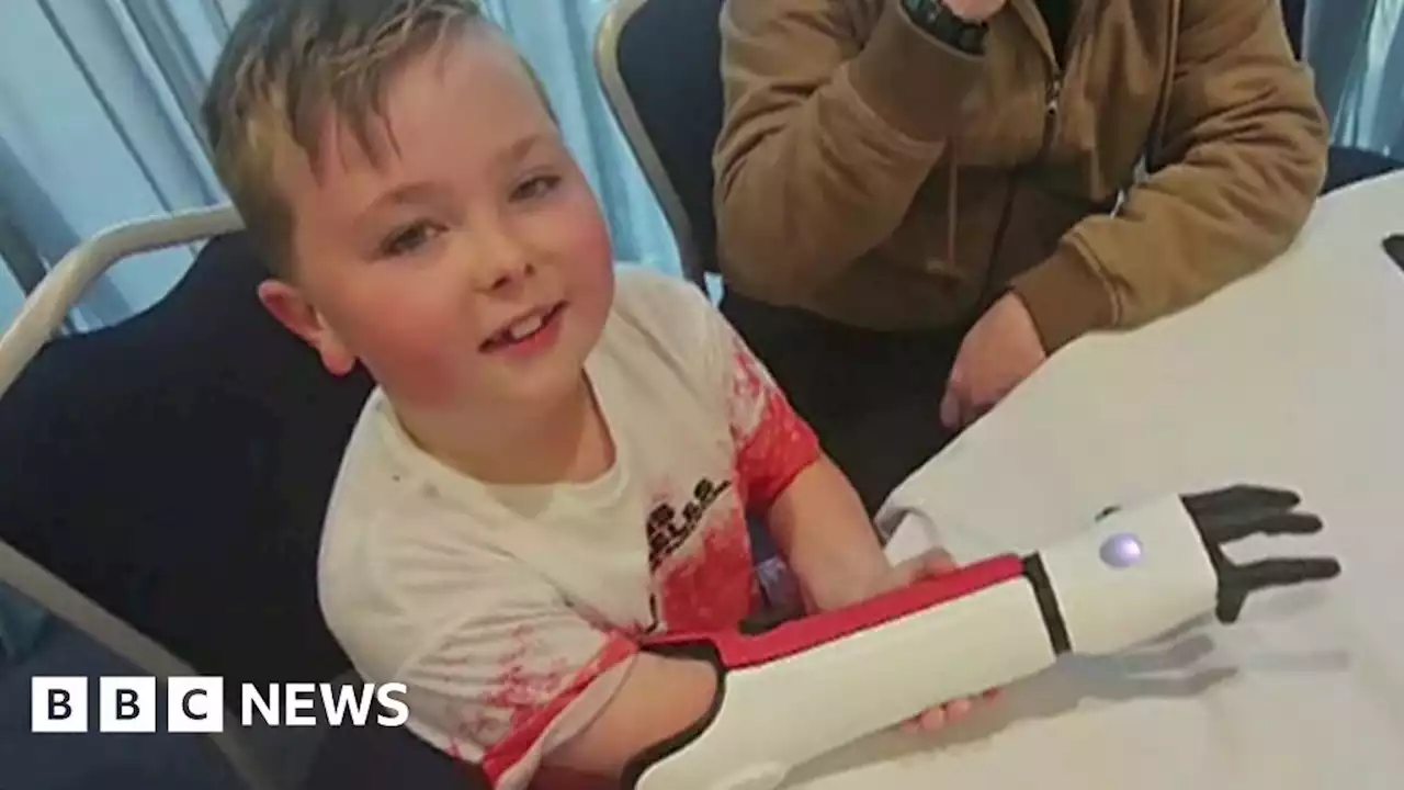 Oswaldtwistle boy, 7, to get bionic arm after plumber donates £12k