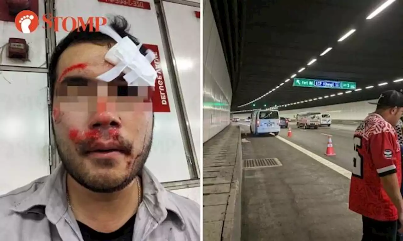 Motorcyclist injured in hit-and-run with 'black car' in MCE tunnel appeals for witnesses