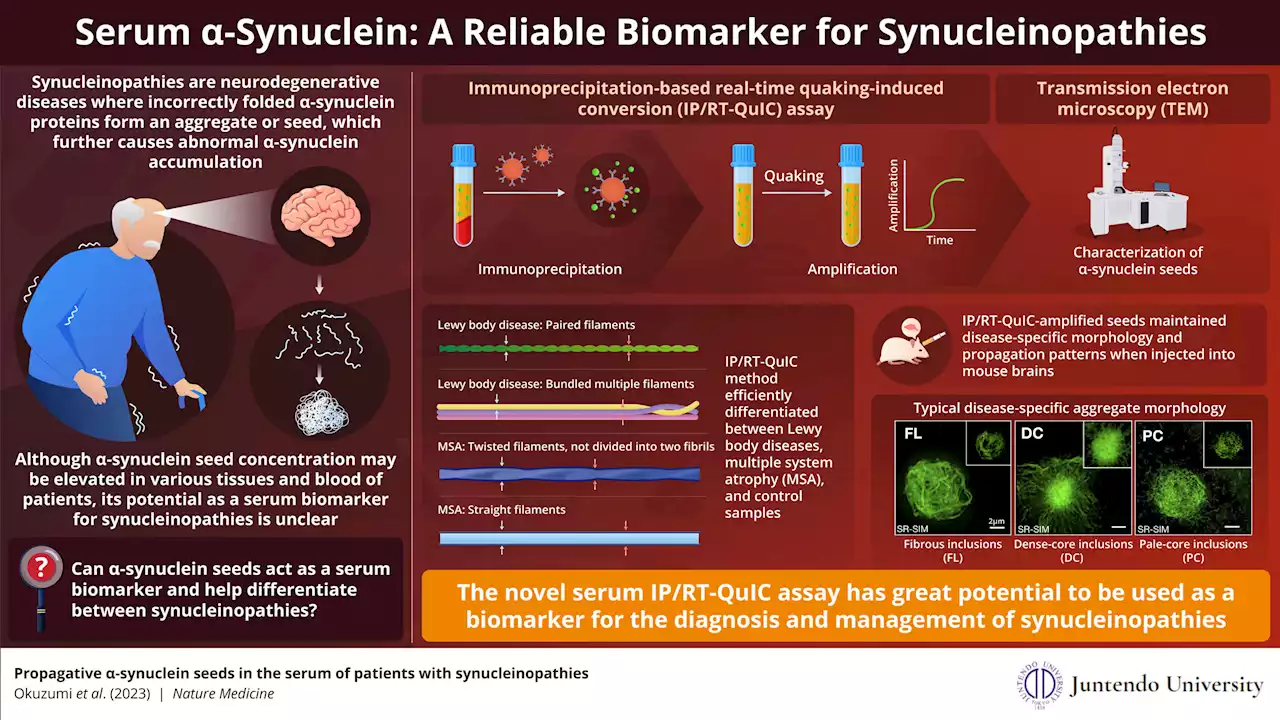 A novel blood serum assay to diagnose neurodegenerative diseases