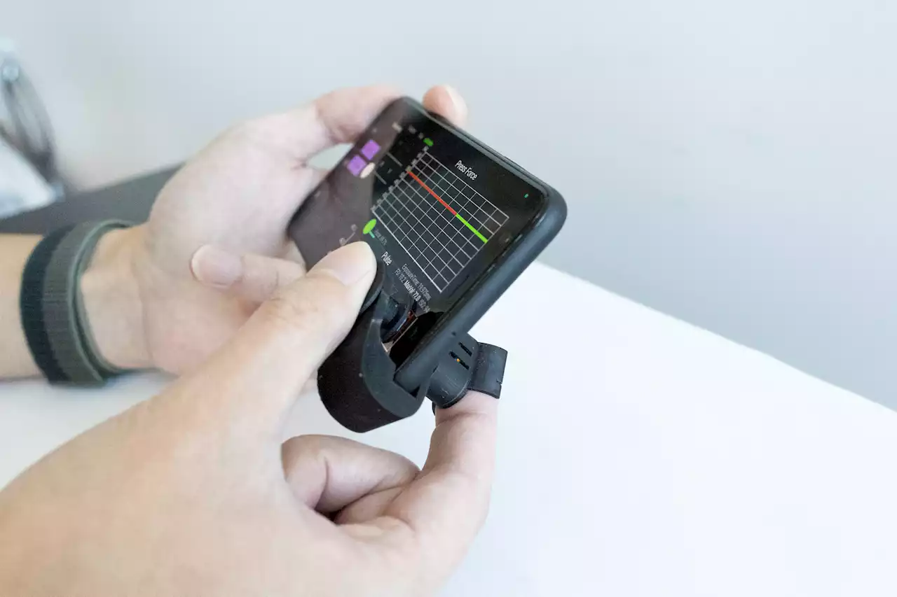 Super low-cost smartphone attachment brings blood pressure monitoring to your fingertips