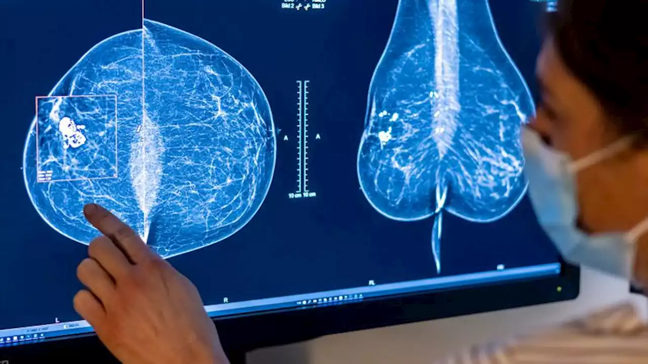 Breast density changes over time could be linked to breast cancer risk, study finds | CNN