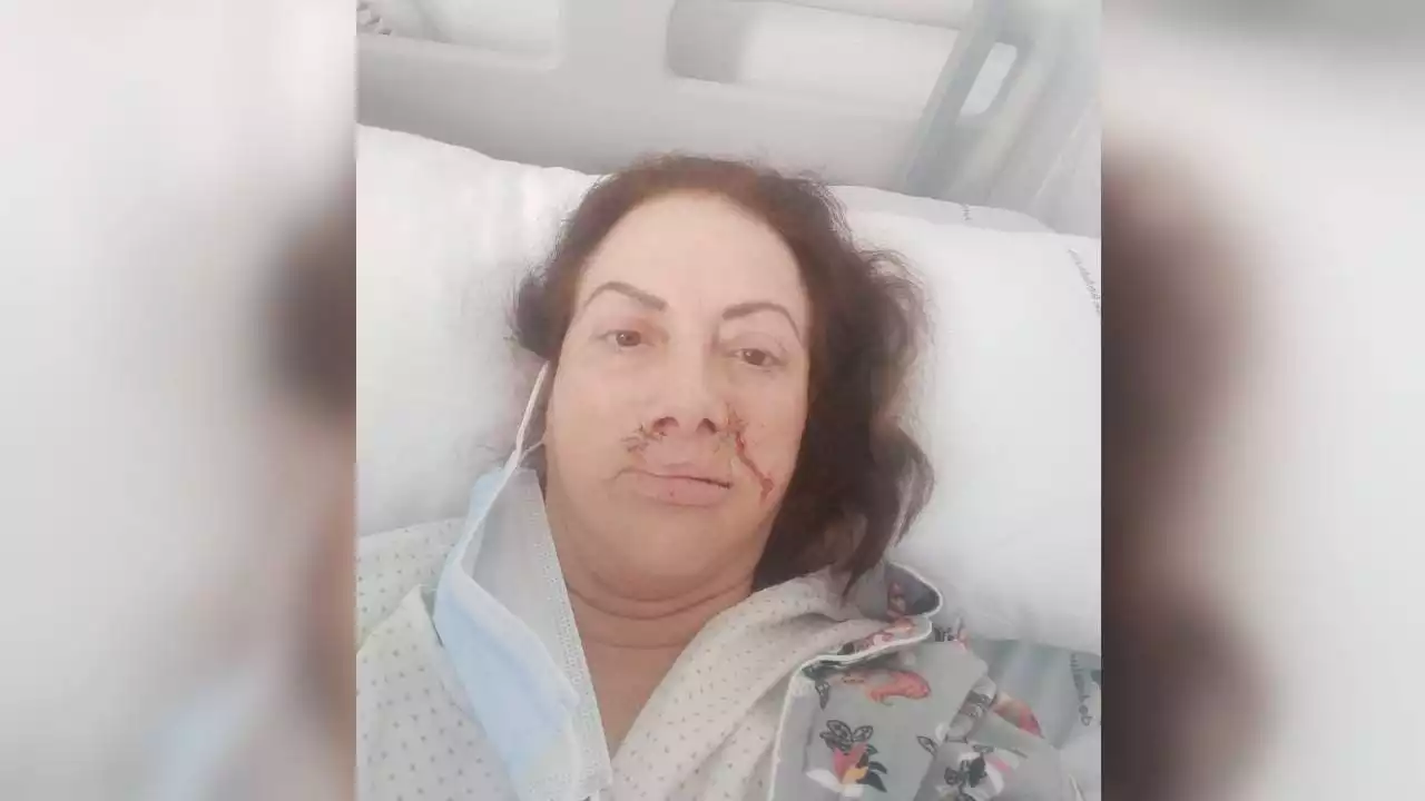 Una mujer denuncia mala praxis médica en Cádiz tras quedar su rostro desfigurado en una operación