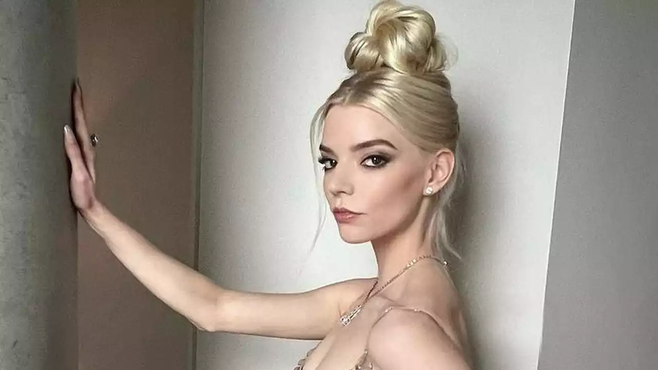 Anya Taylor-Joy Pernah Jadi Korban Body Shaming, Bintang The Queen’s Gambit pun Tak Suka Bercermin hingga Sekarang