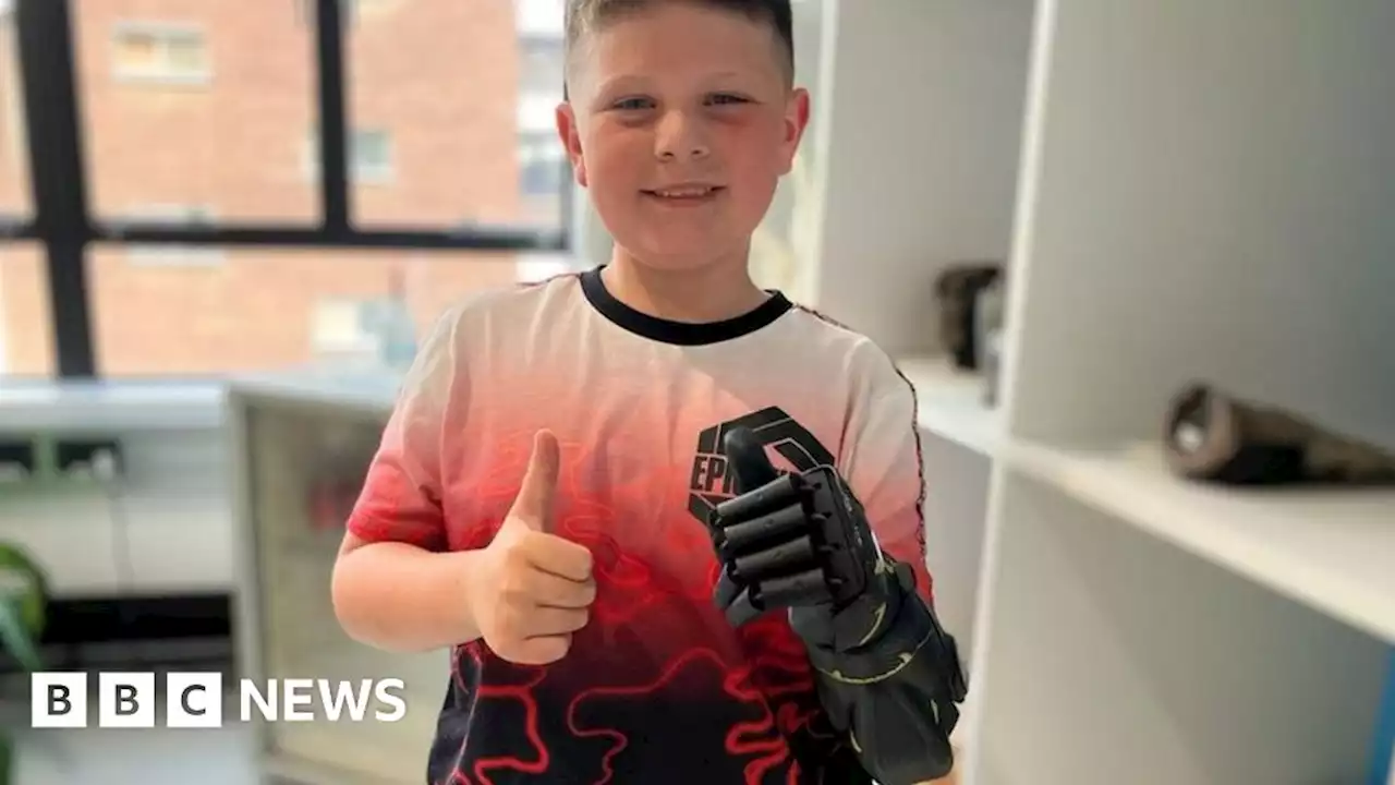 New bionic arm 'absolutely life-changing' for boy from Bude