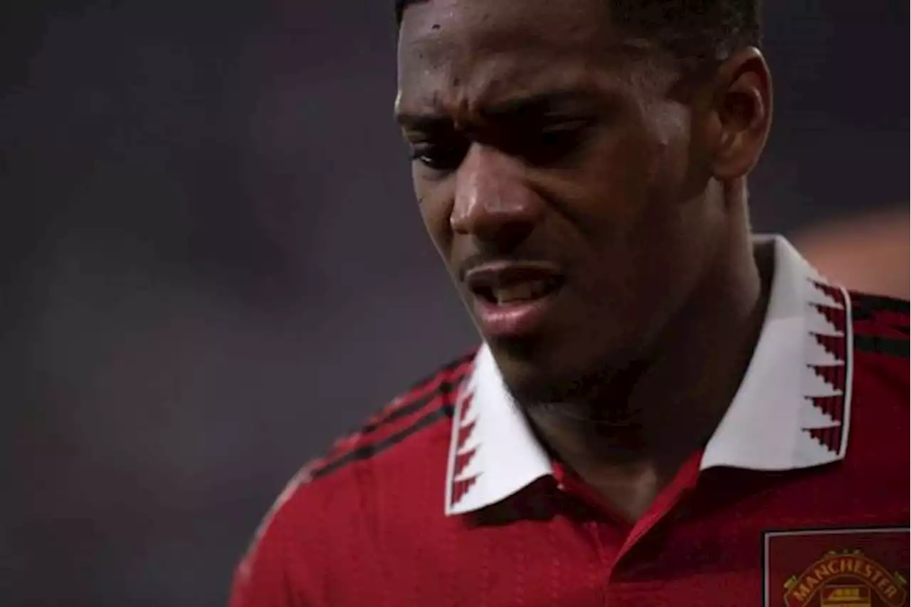 Anthony Martial Dipastikan Absen di Final Piala FA Kontra Manchester City