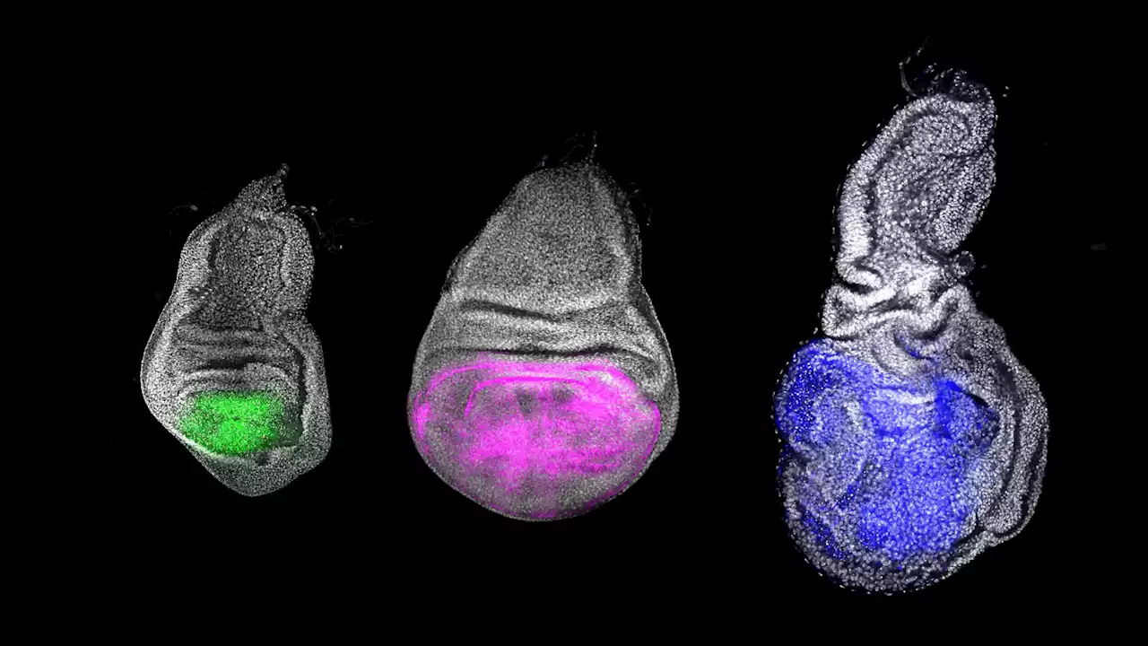 Scientists Discover Chinmo – “The Youth Gene”