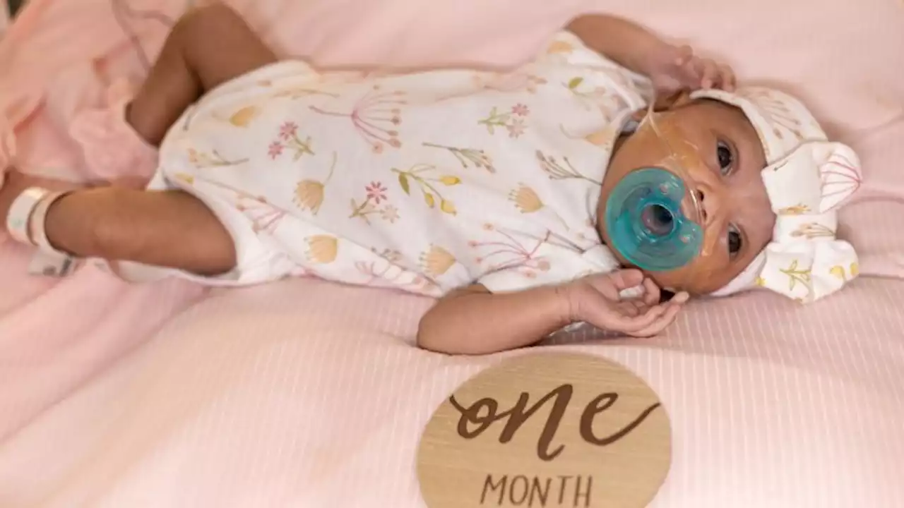 Doctors performed brain surgery on a baby before she was born and now she's thriving | CNN