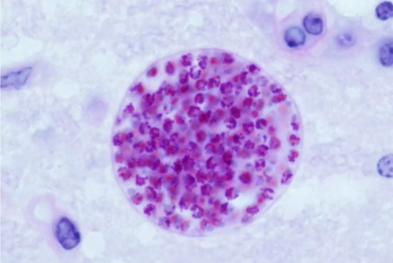 The Myth of 'Mind-Altering Parasite' Toxoplasma Gondii?