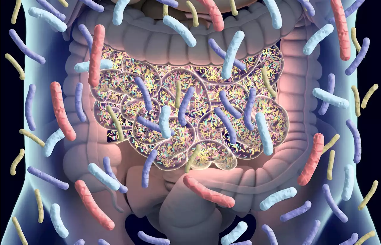 Parkinson's disease-like gut dysbiosis detected in early stages of the disease