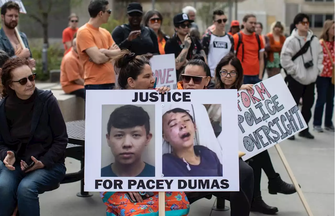 Edmontonians rally for Pacey Dumas, an Indigenous young man kicked in the head by a police officer