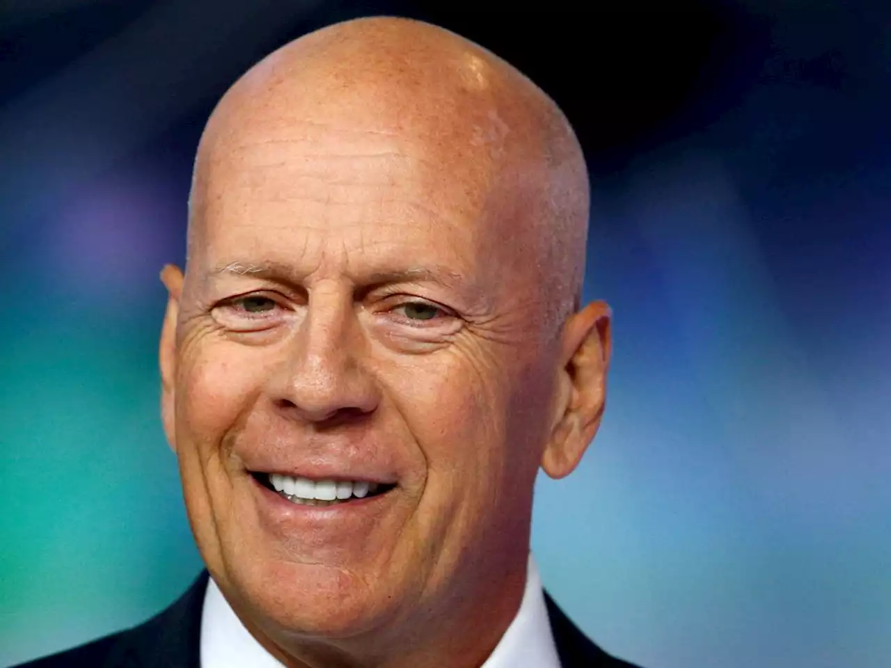 What is frontotemporal dementia? Bruce Willis' condition explained