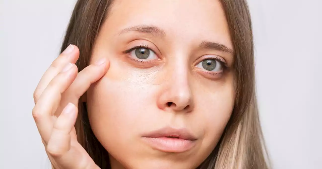 The hero vitamin that can tackle everything from dark circles to stretch marks