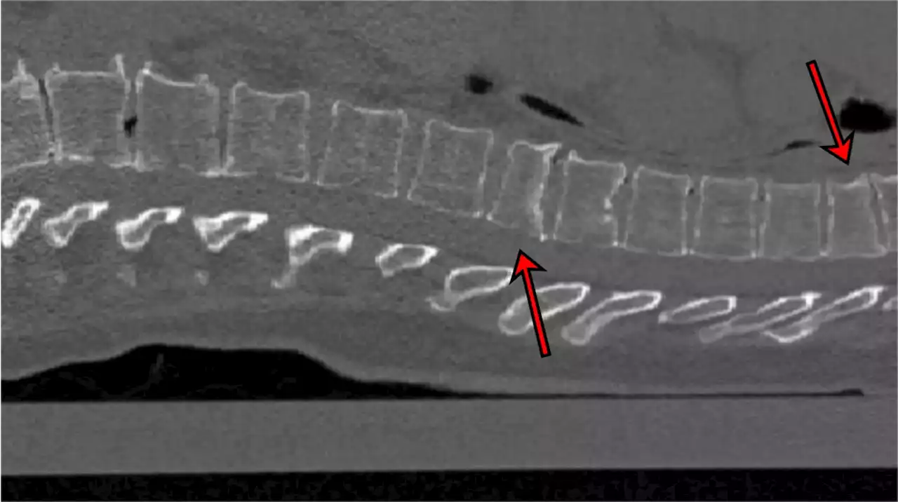 KI-Diagnose: Forscher wollen Knochenbrüche erkennende Software etablieren