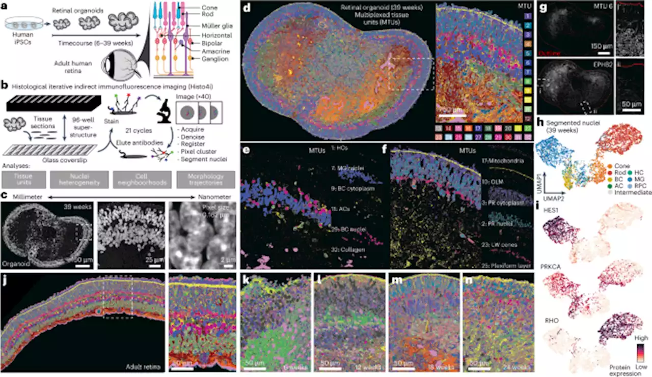 Multimodal spatiotemporal phenotyping of human retinal organoid development - Nature Biotechnology