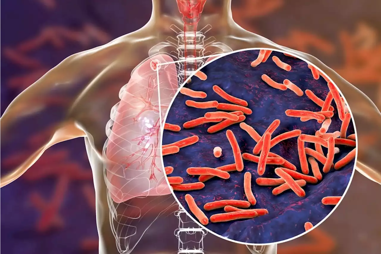 How antiviral host responses create a lung environment susceptible to bacterial and fungal infections