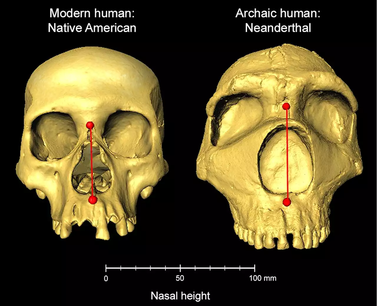 Nose shape gene inherited from Neanderthals