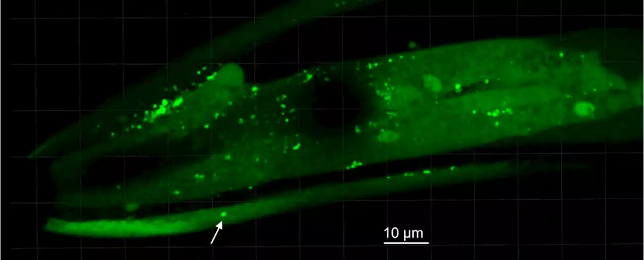 Parkinson's May Be Caused by a Common Aquatic Bacterium