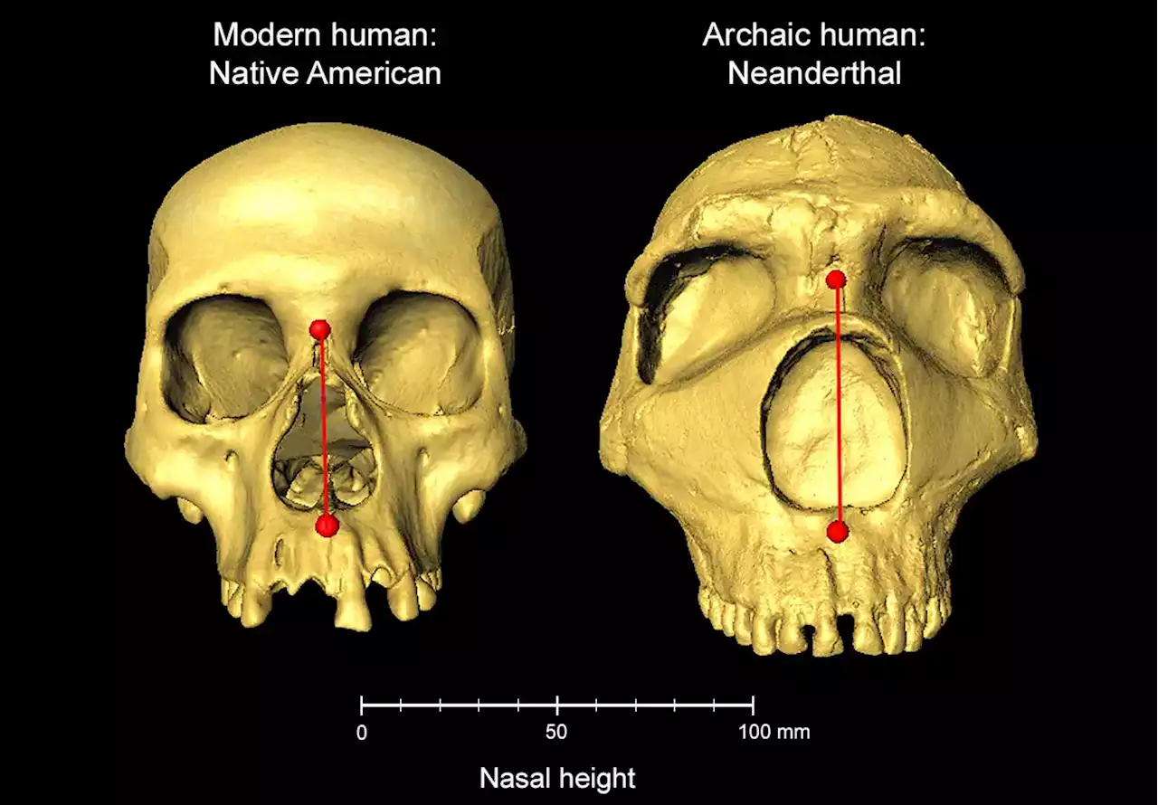 Cold Climate Adaptation: Neanderthal Genetics Shape Our Facial Features