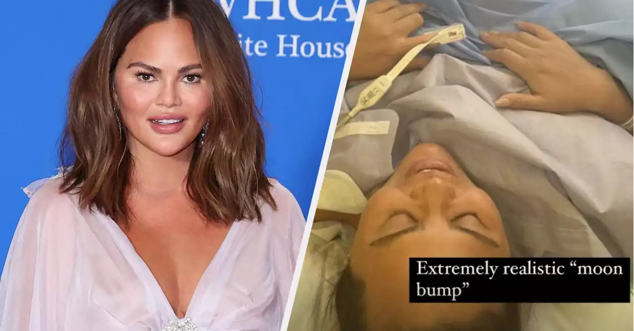 After People Accused Chrissy Teigen Of Using Surrogate For Her Newborn. She Proved She Had A C-Section With Photos