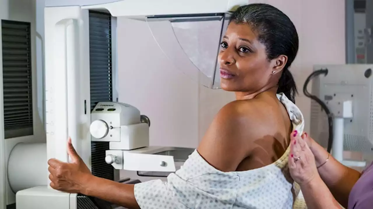 New USPSTF Draft Suggests Mammography Start at 40, Not 50