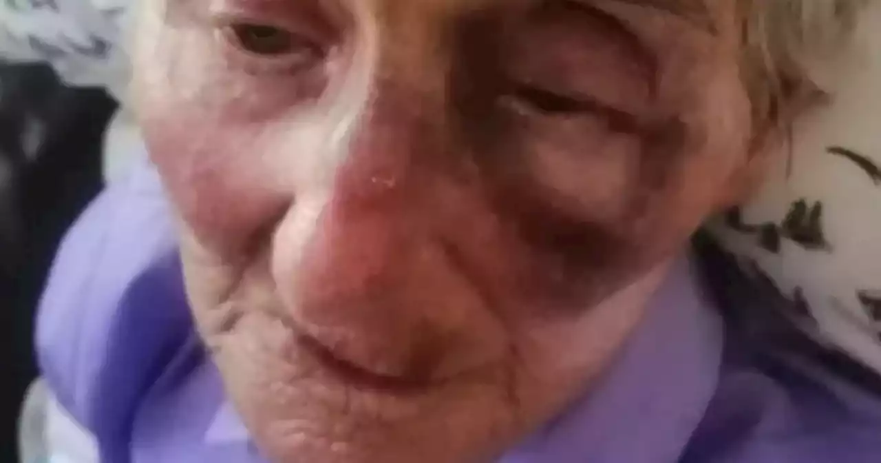 Pensioner left with serious eye injury after being hit with water balloon in car