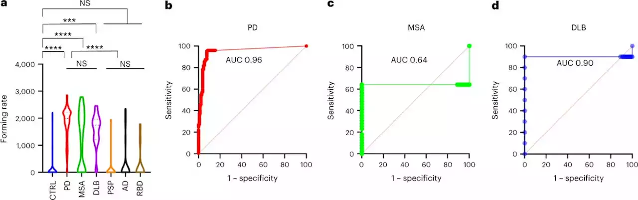 Propagative α-synuclein seeds as serum biomarkers for synucleinopathies - Nature Medicine