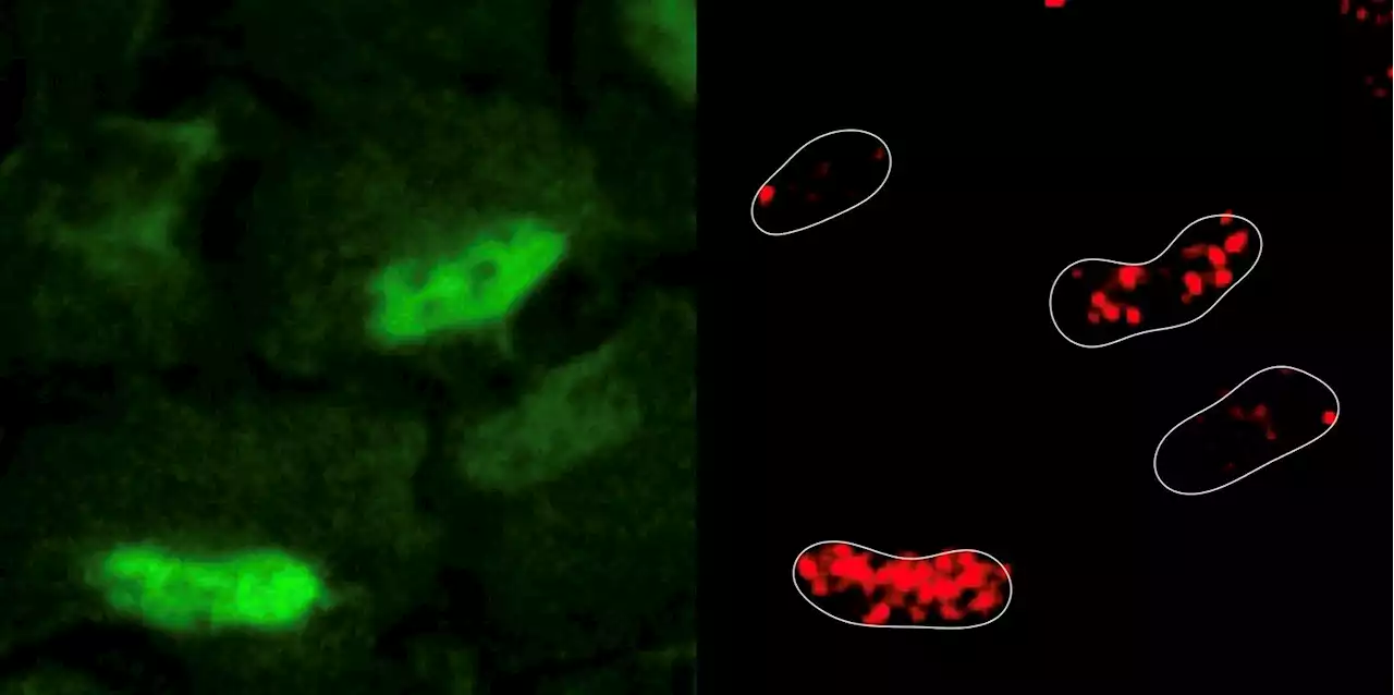 Study examines how DNA damage is repaired by antioxidant enzymes