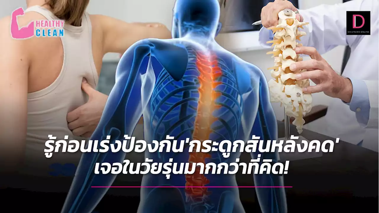 รู้ก่อนเร่งป้องกัน 'กระดูกสันหลังคด' เจอในวัยรุ่นมากกว่าที่คิด! | เดลินิวส์