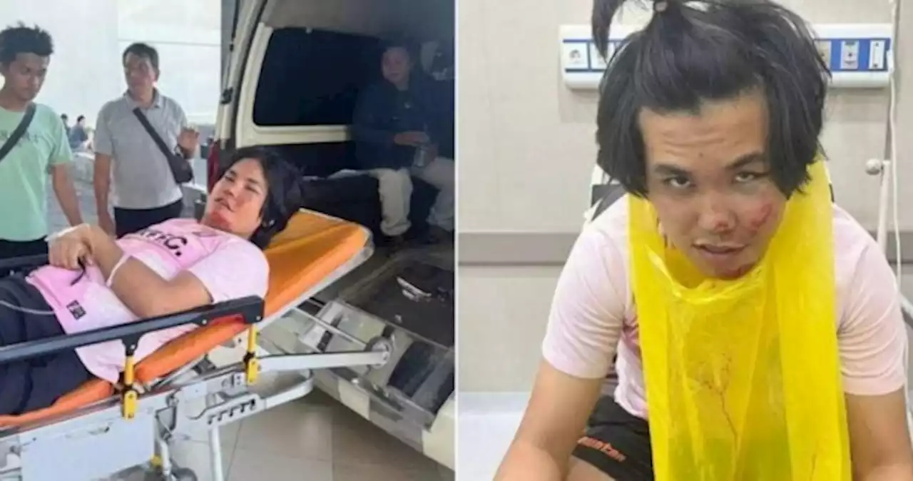 'I can't even remember being in Bali': Singapore student suffers fracture, memory loss after all-terrain vehicle hits tree in Bali