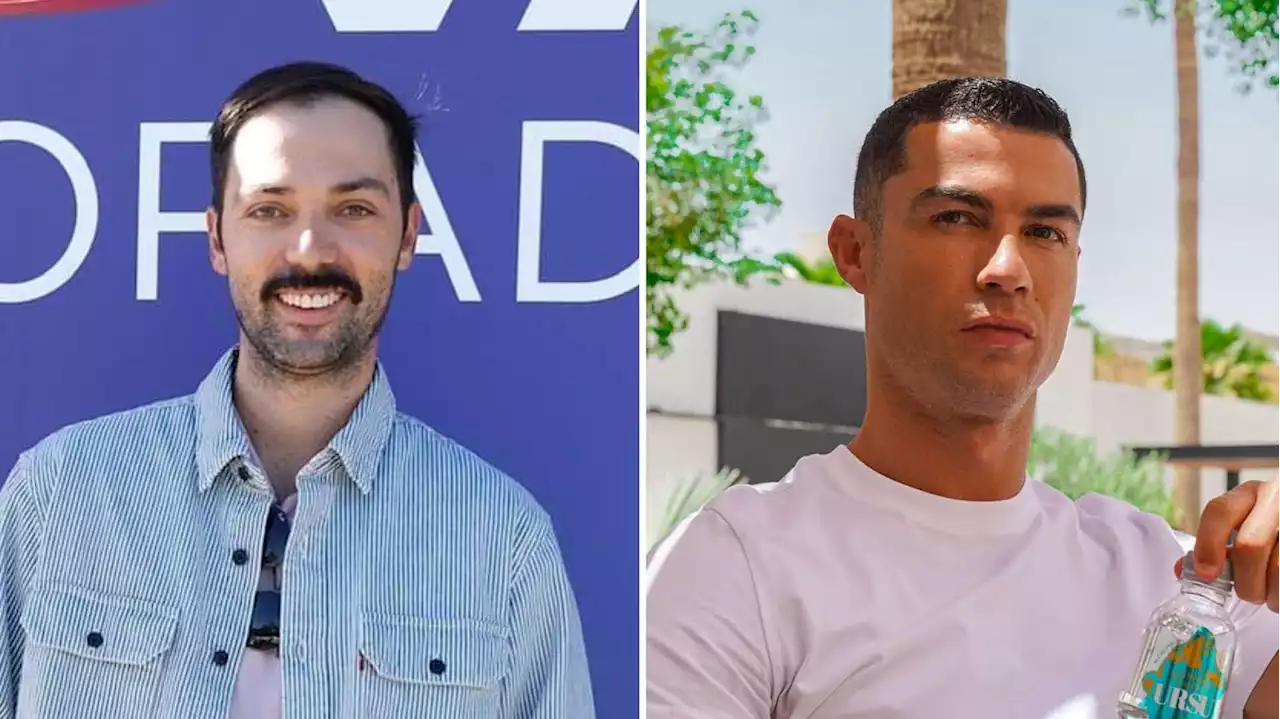 Diogo Valsassina mostra o antes e depois do tratamento estético feito em clínica de Cristiano Ronaldo