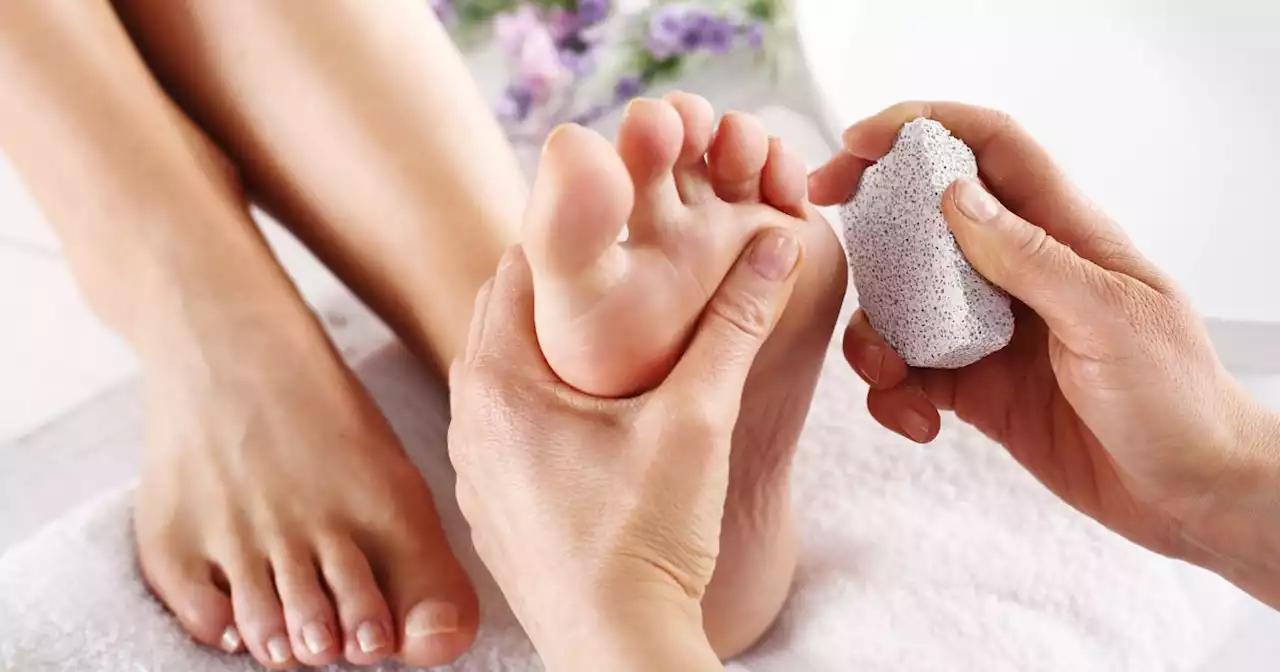 Pieds secs : voici pourquoi l'utilisation d'une râpe à pied est une mauvaise idée