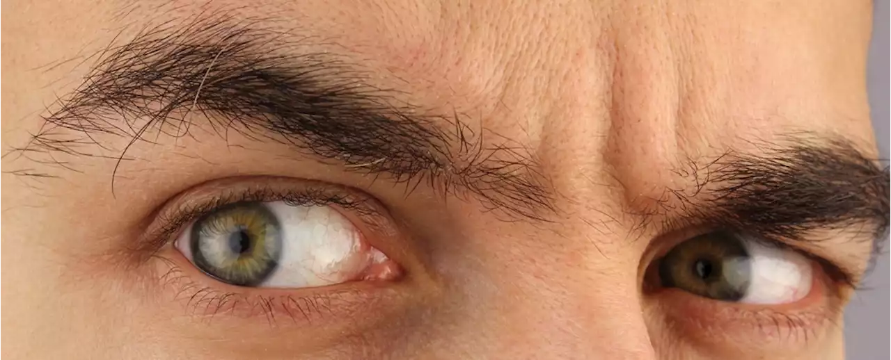 Scientists May Have Figured Out Why Your Eyebrows Look Like That