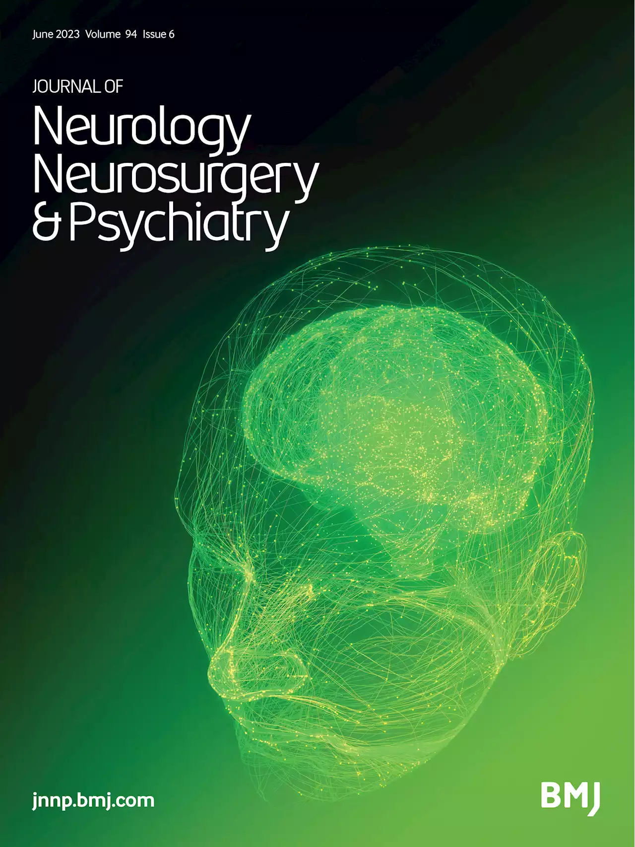 Evoked mid-frontal activity predicts cognitive dysfunction in Parkinson’s disease