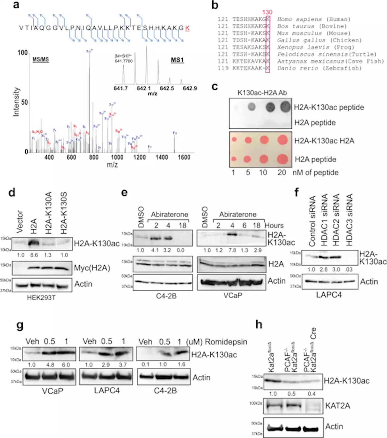 Histone H2A Lys130 acetylation epigenetically regulates androgen production in prostate cancer - Nature Communications