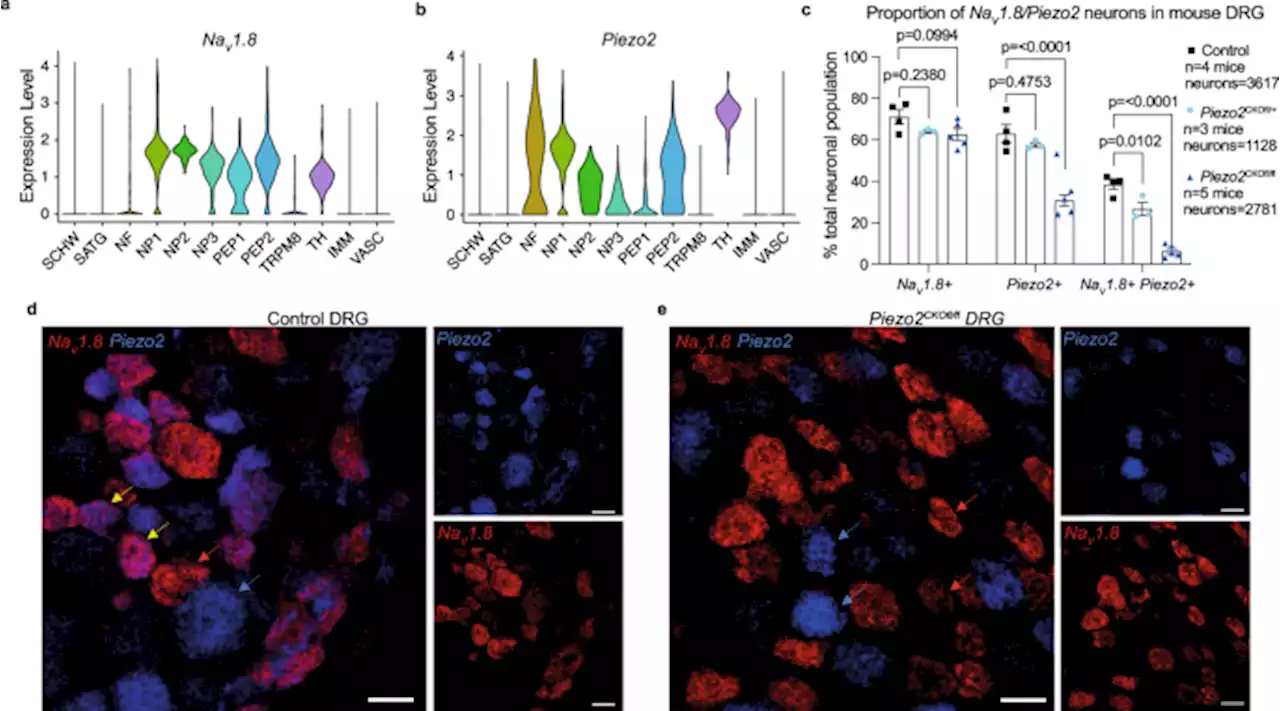 Piezo2 expressing nociceptors mediate mechanical sensitization in experimental osteoarthritis - Nature Communications