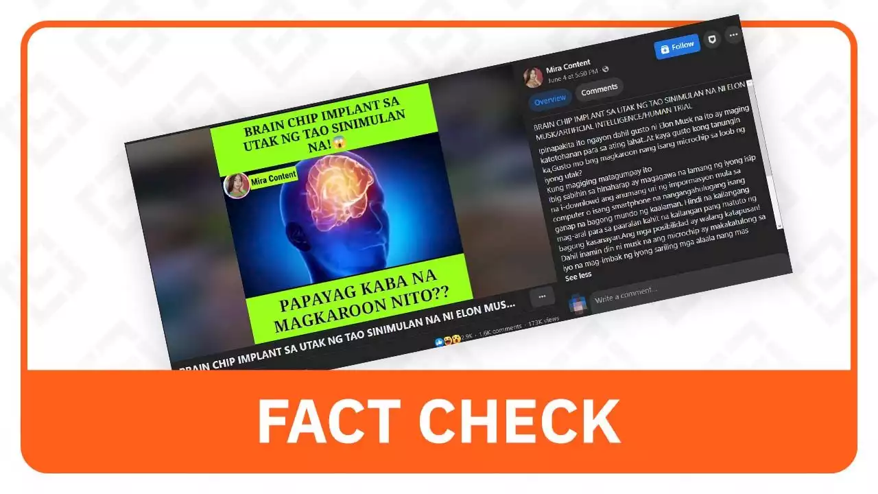 FACT CHECK: Neuralink hasn't started human trial for brain implants