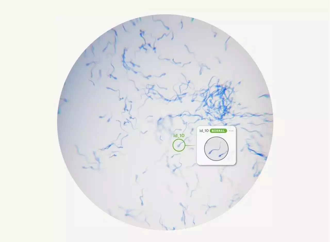 Cientistas desenvolvem inteligência artificial que identifica melhores espermatozoides para fertilização in vitro