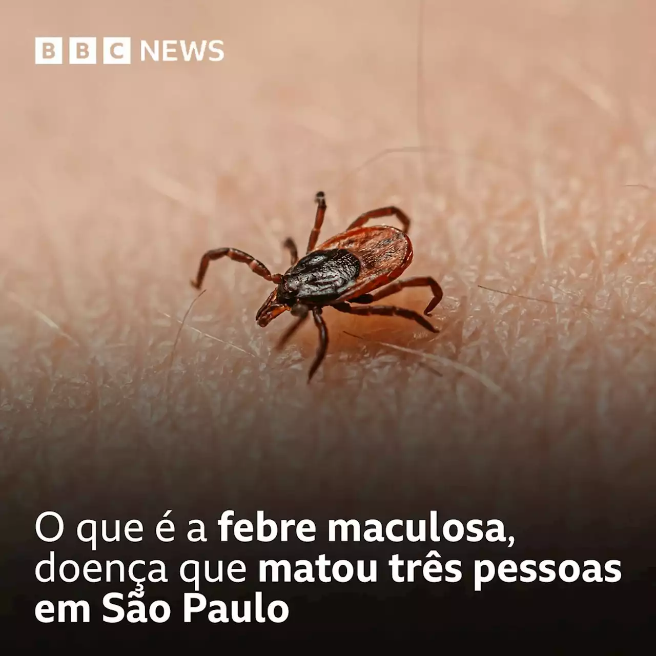 O que é a febre maculosa, doença que matou três pessoas em SP - BBC News Brasil