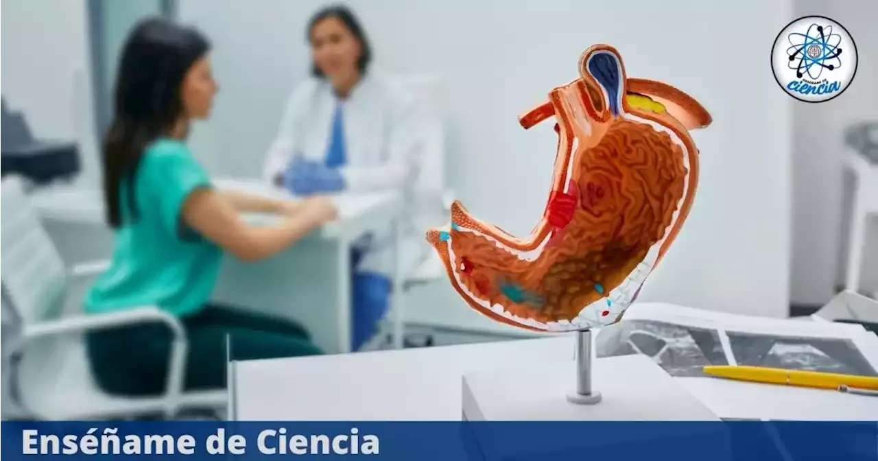 Cáncer Gástrico ¿Cuáles Son Los Síntomas De Alerta Y Por Qué No Debes ...